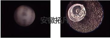 关节镜.jpg