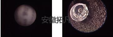 关节镜维修